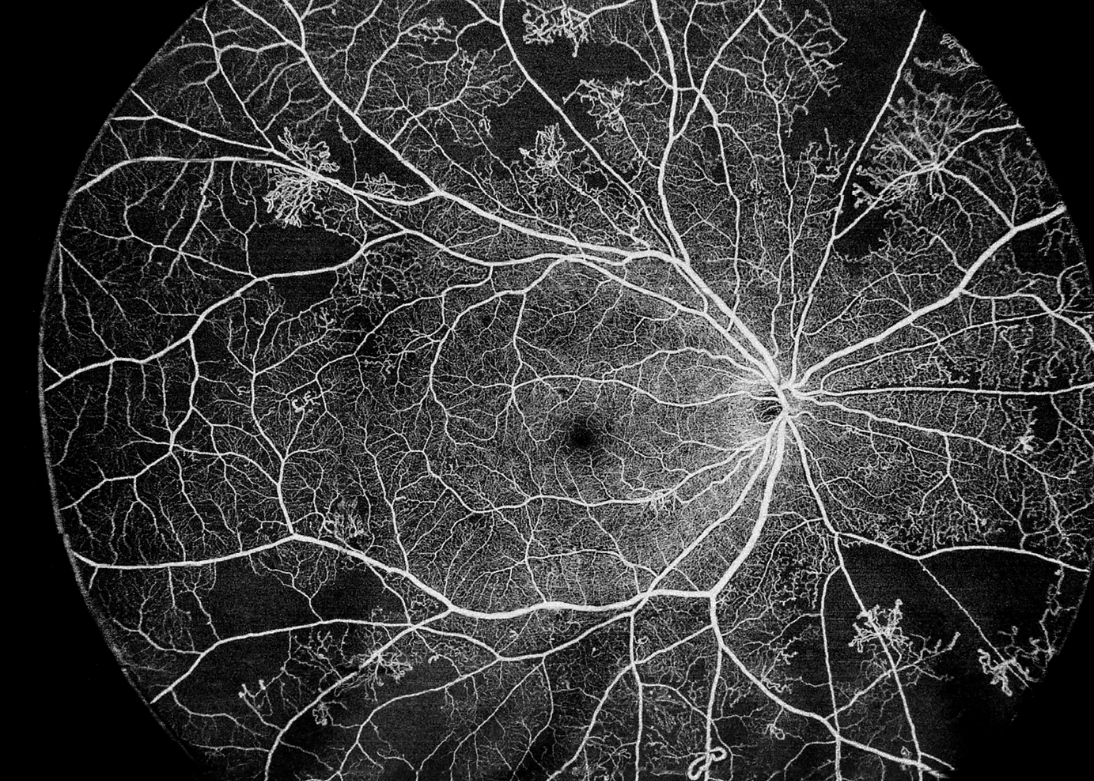 Anterior segment OCT