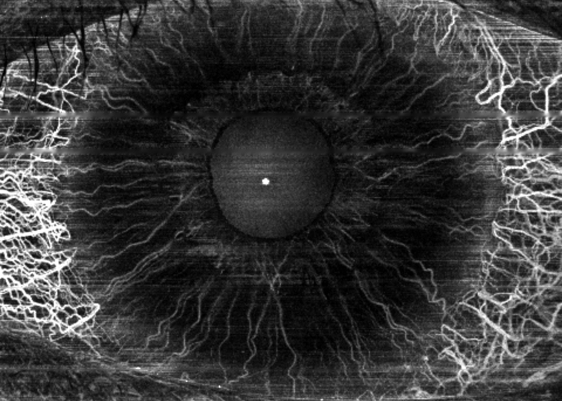 Fundus cSLO image
