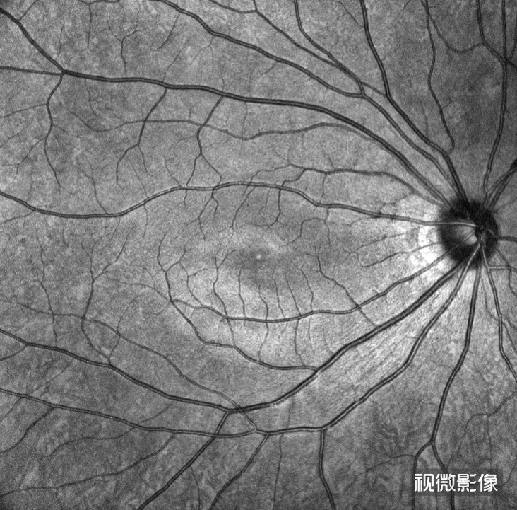 Single scan OCT image from VG-200C