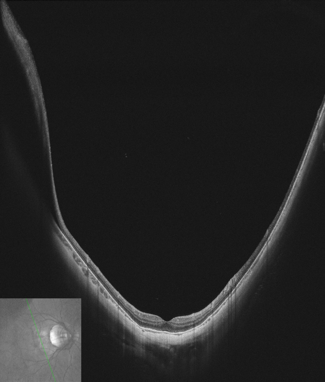 Imaging depth visualization of VG-200C
