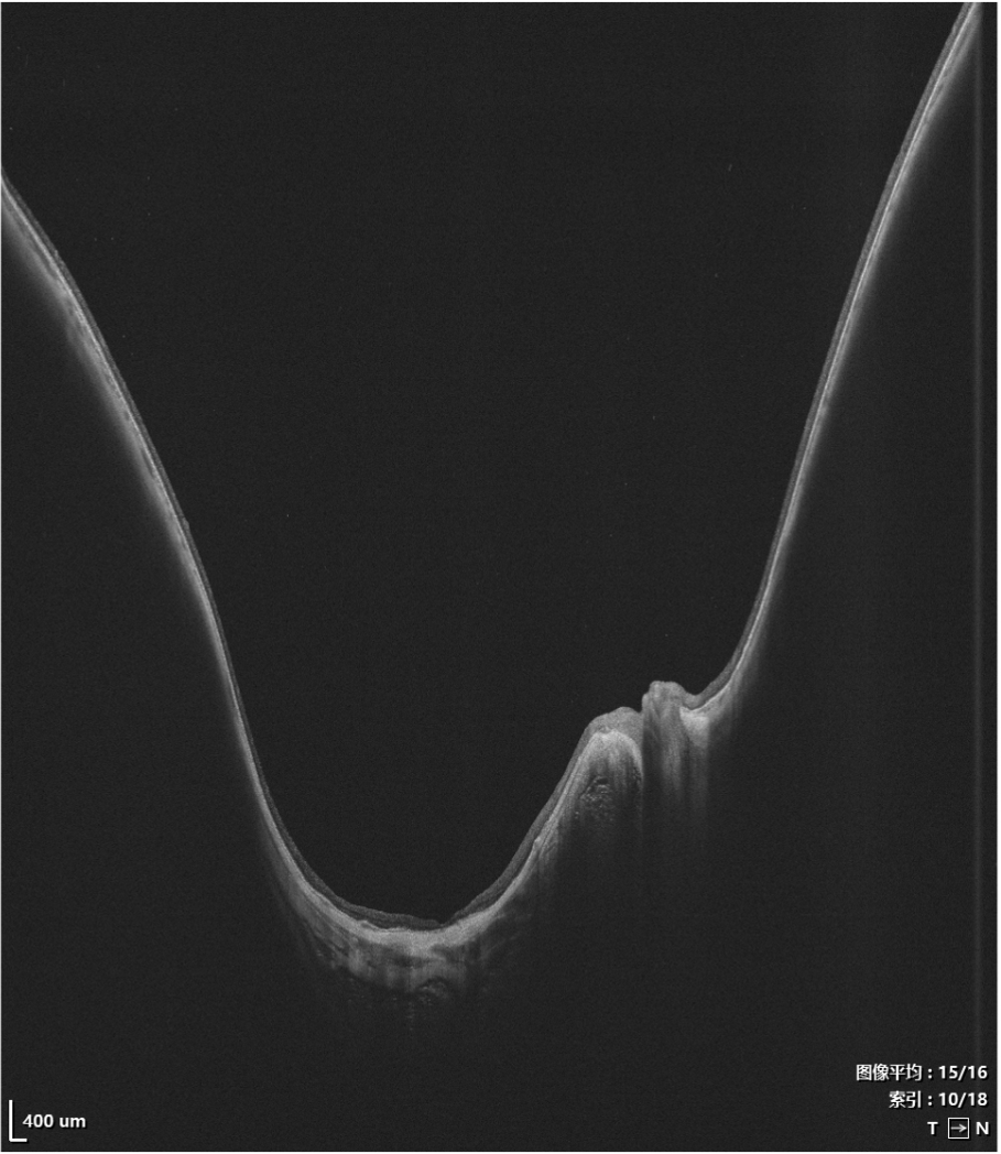 Imaging depth visualization of VG-200I